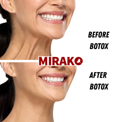 Botox - Botox is a non-surgical, FDA-approved treatment that temporarily relaxes targeted facial muscles to reduce the appearance of dynamic wrinkles, such as frown lines, forehead lines, and crow’s feet. Results typically appear within a few days and can last several months. Botox - Botox is a non-surgical, FDA-approved treatment that temporarily relaxes targeted facial muscles to reduce the appearance of dynamic wrinkles, such as frown lines, forehead lines, and crow’s feet. Results typically appear within a few days and can last several months.