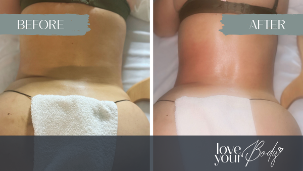 Before and After Photos - We are focused on getting you results for your weight loss, skincare and anti-aging goals. Here are some of a few of the before and afters. Please call us at 727-513-6410 to schedule a free consultation and your first treatment.