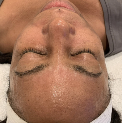 Hydrafacial - At The Sacred Glo, we specialize in customizing a holistic service that will overall enhance your inner well being and your outer beauty. We are experts in laser tattoo removal, hydrafacials, tattoo removal, microblading eyebrows, microneedling, fibroblast skin rejuvenation and more.
Call us today to get a free consultation! Hydrafacial - At The Sacred Glo, we specialize in customizing a holistic service that will overall enhance your inner well being and your outer beauty. We are experts in laser tattoo removal, hydrafacials, tattoo removal, microblading eyebrows, microneedling, fibroblast skin rejuvenation and more.
Call us today to get a free consultation!