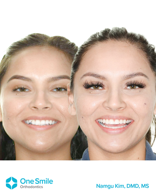 Cases - Actual Patients with One Smile Cases - Actual Patients with One Smile