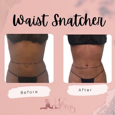 Body Sculpting - Our treatments are created specifically for your body type that the technician customizes to get the best results for your body goals. It consists of 3-8 services in 1 session giving you the fastest most optimal results! All with no pain, needles, or downtime!
Service Options:
-Ultrasonic Cavitation, I-lipo, Radio Frequency Skin Tightening, Detox Sauna Wrap, Wood Therapy (maderoterapia), Endermo Therapy, Electric Muscle Stimulation, Doll Ice, Vacuum Therapy, Cryo Therapy.
Benefits:
-Flatter Stomach
- Body Contouring
-Non- invasive method of fat removal
-Improved circulation
-Reduces Cellulite
-Immediate/Progressive Results
-Collagen Growth
-Tighter and Firmer Skin
-Speed Up Metabolism
-Weight Loss
-More Confidence
Treatment Areas:
-Waist (Whole Torso)
-Stomach
-Arms
-Back
-Legs (front or back)
-Love Handles
-Butt Enhancement
-Cellulite
-Face
-Hands Body Sculpting - Our treatments are created specifically for your body type that the technician customizes to get the best results for your body goals. It consists of 3-8 services in 1 session giving you the fastest most optimal results! All with no pain, needles, or downtime!
Service Options:
-Ultrasonic Cavitation, I-lipo, Radio Frequency Skin Tightening, Detox Sauna Wrap, Wood Therapy (maderoterapia), Endermo Therapy, Electric Muscle Stimulation, Doll Ice, Vacuum Therapy, Cryo Therapy.
Benefits:
-Flatter Stomach
- Body Contouring
-Non- invasive method of fat removal
-Improved circulation
-Reduces Cellulite
-Immediate/Progressive Results
-Collagen Growth
-Tighter and Firmer Skin
-Speed Up Metabolism
-Weight Loss
-More Confidence
Treatment Areas:
-Waist (Whole Torso)
-Stomach
-Arms
-Back
-Legs (front or back)
-Love Handles
-Butt Enhancement
-Cellulite
-Face
-Hands