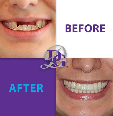Dental Services - some before and after shots of our dental services Dental Services - some before and after shots of our dental services