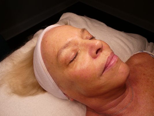 Facials - Experience our exceptional medical grade facials! These advanced treatments are not just a luxury; they are a powerful solution tailored to address your unique skincare needs. Utilizing high-concentrated ingredients and cutting-edge techniques, our medical grade facials penetrate deeper to rejuvenate, repair, and revitalize your skin from within. Say goodbye to dullness, fine lines, uneven tone and texture, and inflammation as we guide you on a personalized journey to uncover your most luminous self. Facials - Experience our exceptional medical grade facials! These advanced treatments are not just a luxury; they are a powerful solution tailored to address your unique skincare needs. Utilizing high-concentrated ingredients and cutting-edge techniques, our medical grade facials penetrate deeper to rejuvenate, repair, and revitalize your skin from within. Say goodbye to dullness, fine lines, uneven tone and texture, and inflammation as we guide you on a personalized journey to uncover your most luminous self.