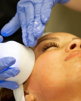 Cryotherapy Facial - Noninvasive cryotherapy facial. Cryotherapy Facial - Noninvasive cryotherapy facial.