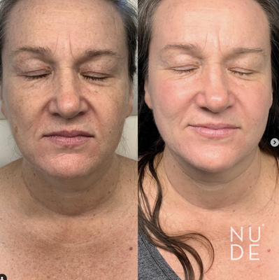 NUDE MEDICAL AESTHETICS - Updated December 2025 - 17 Photos & 13