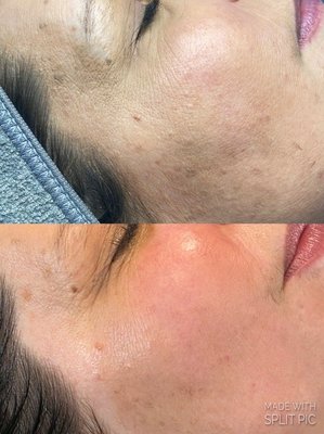 Our Facials - Text now to book your appointment! Our Facials - Text now to book your appointment!