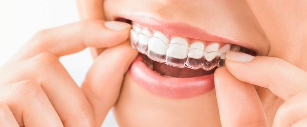 INVISALIGN - Call now to get straight teeth!