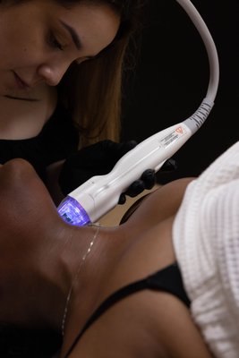 Virtue RF - What Are The Benefits Of Rf Microneedling?
Tighten loose skin
Improve skin texture and tone
Minimize pore size and depth
Minimize fine lines and wrinkles
Improve stretch marks
Improve scars
How Does Virtue Rf Microneedling Work?
The treatment tip has a set of 36 needles that robotically puncture the skin causing micro-injuries in the skin.
Then RF radiofrequency energy is transmitted from the tip of the gold coated needles deep in the skin.
The controlled skin injury and the radiofrequency trigger the skin to heal microscopic wounds by producing new skin cells, collagen, and elastin.
The micro-injuries also produce micro-channels that are used to introduce bioactive ingredients deep in the skin which heal the skin faster, eliminate downtime and boost new skin cell, collagen, and elastin production.
LED blue light on the treatment hand piece kills bacteria, whereas red light has anti-aging benefits.
Over the course of the treatment series, the depth of the needle penetration and the RF energy distribution will be increased for ongoing skin rejuvenation. Virtue RF - What Are The Benefits Of Rf Microneedling?
Tighten loose skin
Improve skin texture and tone
Minimize pore size and depth
Minimize fine lines and wrinkles
Improve stretch marks
Improve scars
How Does Virtue Rf Microneedling Work?
The treatment tip has a set of 36 needles that robotically puncture the skin causing micro-injuries in the skin.
Then RF radiofrequency energy is transmitted from the tip of the gold coated needles deep in the skin.
The controlled skin injury and the radiofrequency trigger the skin to heal microscopic wounds by producing new skin cells, collagen, and elastin.
The micro-injuries also produce micro-channels that are used to introduce bioactive ingredients deep in the skin which heal the skin faster, eliminate downtime and boost new skin cell, collagen, and elastin production.
LED blue light on the treatment hand piece kills bacteria, whereas red light has anti-aging benefits.
Over the course of the treatment series, the depth of the needle penetration and the RF energy distribution will be increased for ongoing skin rejuvenation.