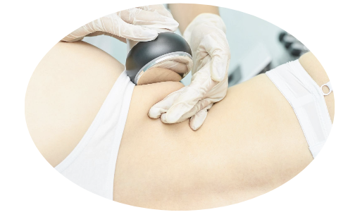 Body Contouring - Body Contouring a set of non-surgical procedures designed to reshape the body. These treatments often include techniques such as radiofrequency, laser therapy, cryolipolysis (fat freezing), or ultrasound to target and reduce stubborn fat deposits. Body contouring aims to improve the body's appearance, enhance contours, and provide a more toned and defined silhouette without the need for invasive surgery. Body Contouring - Body Contouring a set of non-surgical procedures designed to reshape the body. These treatments often include techniques such as radiofrequency, laser therapy, cryolipolysis (fat freezing), or ultrasound to target and reduce stubborn fat deposits. Body contouring aims to improve the body's appearance, enhance contours, and provide a more toned and defined silhouette without the need for invasive surgery.