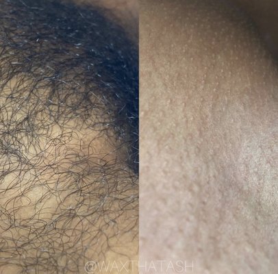 Brazilian Wax - This client came in for her first Brazilian Wax post pandemic. For a Brazilian wax you will be in and out in 15 minutes! First time clients will also receive a complimentary after care kit to care for their new smooth skin. Brazilian Wax - This client came in for her first Brazilian Wax post pandemic. For a Brazilian wax you will be in and out in 15 minutes! First time clients will also receive a complimentary after care kit to care for their new smooth skin.