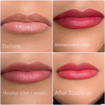 Lip blushing - Benefits of Lip Blushing:
Lip blushing offers several advantages:
1. Natural Enhancement:Achieve naturally flushed and defined lips.
2. Color Customization:Tailor lip color to your preference.
3. Youthful Appearance:Restore lost lip pigment and reduce the signs of aging.
4. No Smudging:Say goodbye to lipstick smudging or reapplication.
5. Time-Saver:Eliminate the need for daily lip makeup.
6. Boosted Confidence:Enjoy enhanced lips and increased self-confidence.
Lip blushing is a popular choice for those seeking effortless, long-lasting lip beauty.3-5 years Lip blushing - Benefits of Lip Blushing:
Lip blushing offers several advantages:
1. Natural Enhancement:Achieve naturally flushed and defined lips.
2. Color Customization:Tailor lip color to your preference.
3. Youthful Appearance:Restore lost lip pigment and reduce the signs of aging.
4. No Smudging:Say goodbye to lipstick smudging or reapplication.
5. Time-Saver:Eliminate the need for daily lip makeup.
6. Boosted Confidence:Enjoy enhanced lips and increased self-confidence.
Lip blushing is a popular choice for those seeking effortless, long-lasting lip beauty.3-5 years