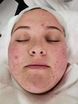 Our Services - Our service providers offer a wide variety of spa and medispa treatments to help you achieve your goals. Our Services - Our service providers offer a wide variety of spa and medispa treatments to help you achieve your goals.