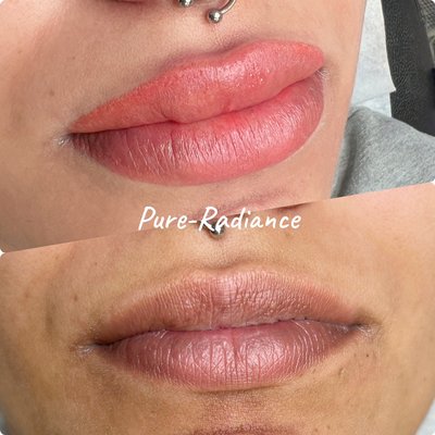 All about lips - Get rid of day lips All about lips - Get rid of day lips