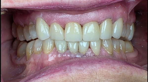 Restored smiles - See our smile gallery on our website for more photos! Restored smiles - See our smile gallery on our website for more photos!