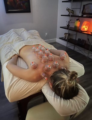 Sports Massage with Cupping Sports Massage with Cupping