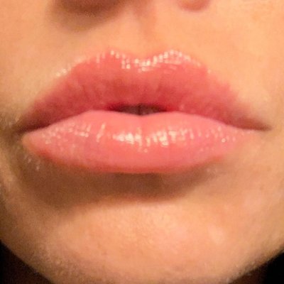 Lippies by BB! - A curated selection of some of our recent lip treatment work from BB Aesthetic Medical Spa.