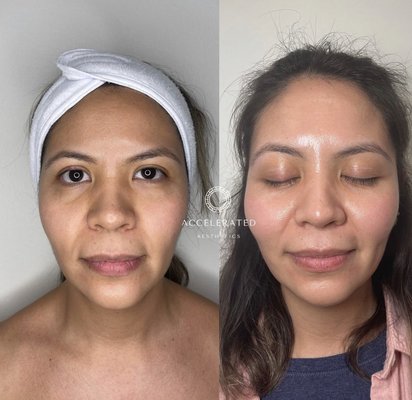 Before and After - Before & After