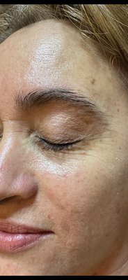 Client Results - Before and Afters