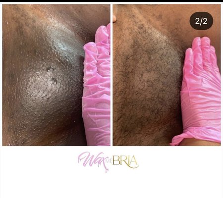 Skin Is Confideu - I Help people remove unwanted hair. Face, body waxing and skin treatments.Educating all about skin wellness and confidence. Skin Is Confideu - I Help people remove unwanted hair. Face, body waxing and skin treatments.Educating all about skin wellness and confidence.