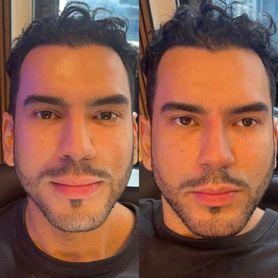 Facial Balancing - Click the link to book your appointment. Facial Balancing - Click the link to book your appointment.