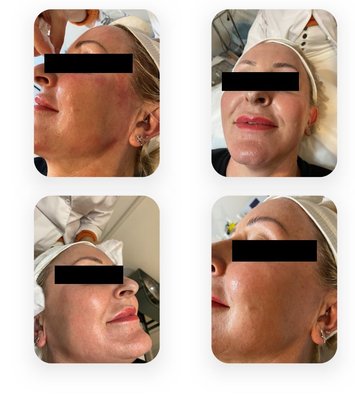 Before & After - These are the before and after pictures of our previous clients. Before & After - These are the before and after pictures of our previous clients.