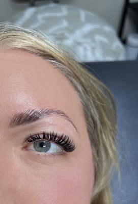 Before and afters - Some retention and full set before and afters. Before and afters - Some retention and full set before and afters.