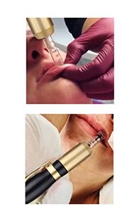 Hyaluronic Lip Fillers - $60 Fall Specials available for Lip Fillers Hyaluronic Lip Fillers - $60 Fall Specials available for Lip Fillers
