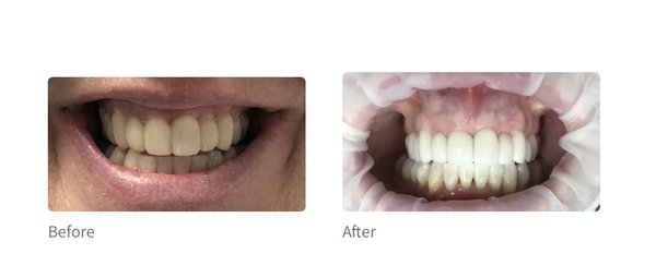 Smile Transformations - We provide smile transformations so our patients leave our practice feeling confident! Smile Transformations - We provide smile transformations so our patients leave our practice feeling confident!