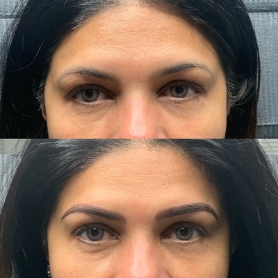 Permanent Makeup - MICROBLADING
Microblading is a semi-permanent cosmetic technique using a handheld tool to infuse the skin with pigment. Individual strokes are feathered into the skin to mimic real hair to achieve the most natural results. With many shades of pigmentation and case-by-case shaping, we can offer a completely personalized experience ending with lovely and manageable brows.