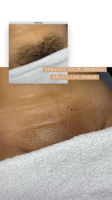 Organic Hair Removal - Organic hair removal. Brazilian includes all hair front and back with the option of a landing strip.