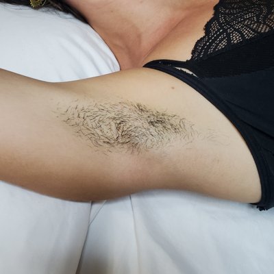 BEFORE & AFTER Underarms - $25 for armpits- WHAT A DEAL!!
For some people who have fast hair growth, Sugaring can be done after not shaving for 7-10 days. You don't have to wait as long for hair to grow when getting sugar-hair removal (compared to waxing) and you don't have little black dots or the 5 O'clock shadow (as compared to shaving). Other advantage is that body odor becomes minimal because the hair root that hold a lot of the odor has been removed. BEFORE & AFTER Underarms - $25 for armpits- WHAT A DEAL!!
For some people who have fast hair growth, Sugaring can be done after not shaving for 7-10 days. You don't have to wait as long for hair to grow when getting sugar-hair removal (compared to waxing) and you don't have little black dots or the 5 O'clock shadow (as compared to shaving). Other advantage is that body odor becomes minimal because the hair root that hold a lot of the odor has been removed.