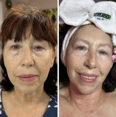 DMK Jet Lux Facial - Call us to book your appointment today! DMK Jet Lux Facial - Call us to book your appointment today!