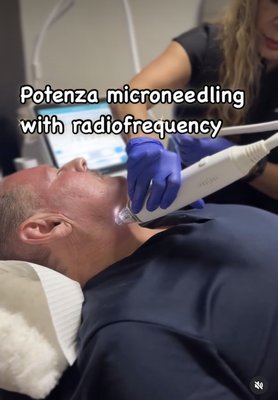 Potenza - Potenza RF Microneedling: Personalized Skin Renewal
Potenza is an advanced radiofrequency (RF) microneedling device that delivers customized skin rejuvenation from the inside out. Unlike traditional microneedling, Potenza combines the benefits of ultra-fine needles with RF energy to trigger your skin’s natural healing process and stimulate collagen and elastin production — for firmer, smoother, and more youthful-looking skin.
Whether you're concerned about acne scars, fine lines, wrinkles, skin laxity, stretch marks, or texture, Potenza offers a personalized solution with minimal downtime.
✨ Why Patients Love Potenza:
Treats all skin types, year-round
Customizable for face, neck, and body
Improves texture, tightness, and tone
Accelerates collagen remodeling
Minimal downtime, long-lasting results
This treatment is ideal for anyone ready to tighten, brighten, and revitalize their skin — naturally. Potenza - Potenza RF Microneedling: Personalized Skin Renewal
Potenza is an advanced radiofrequency (RF) microneedling device that delivers customized skin rejuvenation from the inside out. Unlike traditional microneedling, Potenza combines the benefits of ultra-fine needles with RF energy to trigger your skin’s natural healing process and stimulate collagen and elastin production — for firmer, smoother, and more youthful-looking skin.
Whether you're concerned about acne scars, fine lines, wrinkles, skin laxity, stretch marks, or texture, Potenza offers a personalized solution with minimal downtime.
✨ Why Patients Love Potenza:
Treats all skin types, year-round
Customizable for face, neck, and body
Improves texture, tightness, and tone
Accelerates collagen remodeling
Minimal downtime, long-lasting results
This treatment is ideal for anyone ready to tighten, brighten, and revitalize their skin — naturally.