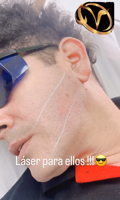 ✨ Ready for a clean, sharp look? - ✨ Laser hair removal for beard shaping is ideal for men who want to maintain a well-groomed, defined look. This treatment permanently removes unwanted hair in areas like the cheeks, neck, and temples, achieving a symmetrical and polished facial shape. 🌟 ✨ Ready for a clean, sharp look? - ✨ Laser hair removal for beard shaping is ideal for men who want to maintain a well-groomed, defined look. This treatment permanently removes unwanted hair in areas like the cheeks, neck, and temples, achieving a symmetrical and polished facial shape. 🌟
