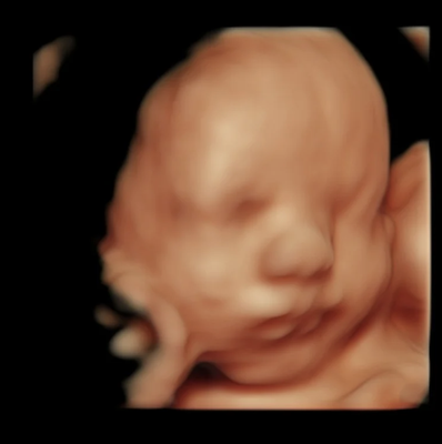 Third Trimester (28+ weeks) - Third Trimester 3rd Trimester 2D Ultrasound & 3rd Trimester 3D | 4D | HD Ultrasound.