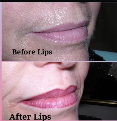 Before & After Lips - Before & After Lips Before & After Lips - Before & After Lips