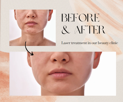 Fillers, Botox, Skin Care & More - At Dew Aesthetics and Wellness, we offer a range of services designed to enhance your appearance and boost your confidence. From dermal fillers and Botox to laser hair removal and skin resurfacing, our expert team is here to help you achieve your beauty goals. Experience personalized care and stunning results in a welcoming environment. Transform your look and feel your best with Dew Aesthetics and Wellness.
Dermal Fillers
Enhance facial contours and reduce wrinkles with our range of dermal fillers.
Botox / Dysport
Smooth out fine lines and wrinkles for a youthful appearance.
Hair Removal
Achieve smooth, hair-free skin with our advanced laser technology.
Skin Resurfacing
Improve skin texture and tone with our skin resurfacing treatments.
Sculptra
Restore facial volume and stimulate collagen growth for long-lasting results.
Lip Augmentation
Achieve fuller, more defined lips with our lip filler treatments.
Microneedling/PRP
Lift and tighten the skin without surgery using advanced techniques.
Chemical Peels
Exfoliate and rejuvenate your skin with our customized chemical peels.
Call us today to schedule your free consultation! We are happy to answer any questions you may have. Fillers, Botox, Skin Care & More - At Dew Aesthetics and Wellness, we offer a range of services designed to enhance your appearance and boost your confidence. From dermal fillers and Botox to laser hair removal and skin resurfacing, our expert team is here to help you achieve your beauty goals. Experience personalized care and stunning results in a welcoming environment. Transform your look and feel your best with Dew Aesthetics and Wellness.
Dermal Fillers
Enhance facial contours and reduce wrinkles with our range of dermal fillers.
Botox / Dysport
Smooth out fine lines and wrinkles for a youthful appearance.
Hair Removal
Achieve smooth, hair-free skin with our advanced laser technology.
Skin Resurfacing
Improve skin texture and tone with our skin resurfacing treatments.
Sculptra
Restore facial volume and stimulate collagen growth for long-lasting results.
Lip Augmentation
Achieve fuller, more defined lips with our lip filler treatments.
Microneedling/PRP
Lift and tighten the skin without surgery using advanced techniques.
Chemical Peels
Exfoliate and rejuvenate your skin with our customized chemical peels.
Call us today to schedule your free consultation! We are happy to answer any questions you may have.