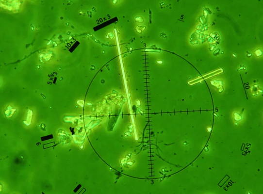 Fiberglass Lab Analysis - Our Fiberglass Services
1. PCM Air Samples (NIOSH 7400, Rule B)
Our laboratory is pleased to offer air sample analysis utilizing NIOSH Method 7400 to determine the presence of airborne fiber concentrations.
2. PLM Qualitative Dust Wipe
Our analysts can analyze submitted dust wipe samples to determine if fiberglass fibers are present with our PLM Qualitative Dust service. Dust wipes are placed in a muffle furnace for approximately 10-12 hours (depending on the dust loading on the wipes) to burn off the wipe and any other non-combustible materials. Our analysts then sift through all of the remaining ash to determine if fiberglass fibers are present; results are reported as either “No Fiberglass Detected” or “Fiberglass Detected” (qualitative results). Fiberglass Lab Analysis - Our Fiberglass Services
1. PCM Air Samples (NIOSH 7400, Rule B)
Our laboratory is pleased to offer air sample analysis utilizing NIOSH Method 7400 to determine the presence of airborne fiber concentrations.
2. PLM Qualitative Dust Wipe
Our analysts can analyze submitted dust wipe samples to determine if fiberglass fibers are present with our PLM Qualitative Dust service. Dust wipes are placed in a muffle furnace for approximately 10-12 hours (depending on the dust loading on the wipes) to burn off the wipe and any other non-combustible materials. Our analysts then sift through all of the remaining ash to determine if fiberglass fibers are present; results are reported as either “No Fiberglass Detected” or “Fiberglass Detected” (qualitative results).