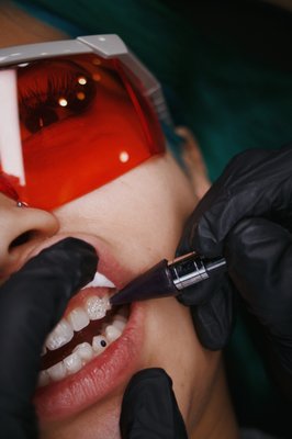 Tooth Gems - Tooth Gems by our artists at The Neon Door.