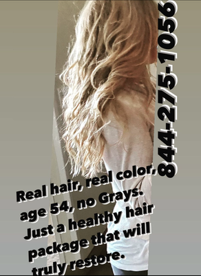 Alopecia? Male Pattern Baldness? Female Pattern Baldness? White Gray or Silver Hair? Turn it around naturally - When you lose hair or go gray early you are deficient, it has NOTHING to do with growing older. The body is always talking to us. We may not listen, but it’s always reporting back about what’s going on with it, how it’s responding to our actions and what we’re doing wrong and right. Want to do something about it? 844-275-1056 or schedule thebodycan.com/schedule with Naturopathic Doctor Randi Shannon Alopecia? Male Pattern Baldness? Female Pattern Baldness? White Gray or Silver Hair? Turn it around naturally - When you lose hair or go gray early you are deficient, it has NOTHING to do with growing older. The body is always talking to us. We may not listen, but it’s always reporting back about what’s going on with it, how it’s responding to our actions and what we’re doing wrong and right. Want to do something about it? 844-275-1056 or schedule thebodycan.com/schedule with Naturopathic Doctor Randi Shannon