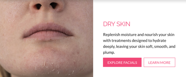 Dry Skin Facials - Call us to book your appointment today! Dry Skin Facials - Call us to book your appointment today!