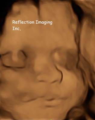 3D/4D Baby Ultrasound Experience - Elective 3D/4D ultrasound session providing detailed images of your baby in a comfortable and welcoming environment. Includes digital image and printed keepsakes. Performed by experienced ultrasound professionals. 3D/4D Baby Ultrasound Experience - Elective 3D/4D ultrasound session providing detailed images of your baby in a comfortable and welcoming environment. Includes digital image and printed keepsakes. Performed by experienced ultrasound professionals.