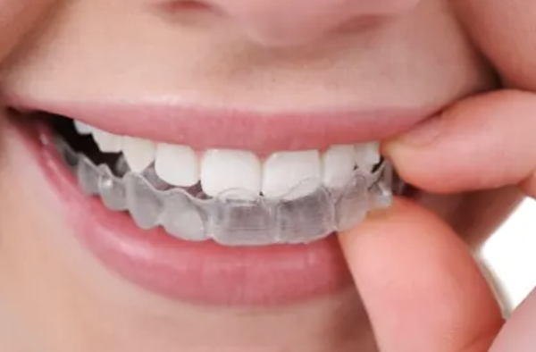 Invisalign - Invisalign uses a series of invisible, removable, and comfortable aligners that no one can tell you're wearing. So you can smile more during treatment as well as after.
About Invisalign
Invisalign is made with 3-D computer imaging technology and has been proven effective. More than 70% of orthodontists in the US and Canada are certified to treat with Invisalign.
Why Would I Want Invisalign?
Not only are the aligners invisible, they are removable, so you can eat and drink what you want while in treatment, plus brushing and flossing are no problem. They are also comfortable, with no metal to cause mouth abrasions during treatment. And no metal and wires usually means you spend less time in your doctor's office getting adjustments.
How Does Invisalign Work?
You wear each set of aligners for 1 week, removing them only to eat, drink, brush, and floss. As you replace each aligner, your teeth will move - little by little, week by week - until they have straightened to the final position. You'll visit Leber Orthodontics about once every 6 weeks to ensure that your treatment is progressing as planned.
Learn more at invisalign.com.
Does Invisalign Hurt?
Both braces and Invisalign will cause dull pain in the process of moving your teeth. Since your teeth don't know whether they're being shifted by metal brackets or plastic aligners, the level of discomfort is usually similar with both treatments. However, with Invisalign, you won’t have to worry about irritation from metal brackets or wires poking your mouth. Invisalign offer a more comfortable, smooth option for straightening your teeth while still being just as effective.
Should I Get Invisalign or Braces?
Braces are fixed to your teeth with wires, so once they're on, there's no taking them off until treatment is complete. You won’t have to worry about forgetting them or not following instructions since they stay in place. Invisalign, on the other hand, uses clear aligners that you can take out, but you’ll need to wear them for about 22 hours each day. At each adjustment visit, you'll get a set of 4-6 new aligners, and each one gently shifts your teeth a little more to their ideal position. Both Invisalign and braces work effectively to give you a straighter smile. For a full comparison, see Braces vs Invisalign. Invisalign - Invisalign uses a series of invisible, removable, and comfortable aligners that no one can tell you're wearing. So you can smile more during treatment as well as after.
About Invisalign
Invisalign is made with 3-D computer imaging technology and has been proven effective. More than 70% of orthodontists in the US and Canada are certified to treat with Invisalign.
Why Would I Want Invisalign?
Not only are the aligners invisible, they are removable, so you can eat and drink what you want while in treatment, plus brushing and flossing are no problem. They are also comfortable, with no metal to cause mouth abrasions during treatment. And no metal and wires usually means you spend less time in your doctor's office getting adjustments.
How Does Invisalign Work?
You wear each set of aligners for 1 week, removing them only to eat, drink, brush, and floss. As you replace each aligner, your teeth will move - little by little, week by week - until they have straightened to the final position. You'll visit Leber Orthodontics about once every 6 weeks to ensure that your treatment is progressing as planned.
Learn more at invisalign.com.
Does Invisalign Hurt?
Both braces and Invisalign will cause dull pain in the process of moving your teeth. Since your teeth don't know whether they're being shifted by metal brackets or plastic aligners, the level of discomfort is usually similar with both treatments. However, with Invisalign, you won’t have to worry about irritation from metal brackets or wires poking your mouth. Invisalign offer a more comfortable, smooth option for straightening your teeth while still being just as effective.
Should I Get Invisalign or Braces?
Braces are fixed to your teeth with wires, so once they're on, there's no taking them off until treatment is complete. You won’t have to worry about forgetting them or not following instructions since they stay in place. Invisalign, on the other hand, uses clear aligners that you can take out, but you’ll need to wear them for about 22 hours each day. At each adjustment visit, you'll get a set of 4-6 new aligners, and each one gently shifts your teeth a little more to their ideal position. Both Invisalign and braces work effectively to give you a straighter smile. For a full comparison, see Braces vs Invisalign.