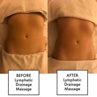 Post-Operation Lymphatic Massage - Call for a Free Consultation Post-Operation Lymphatic Massage - Call for a Free Consultation