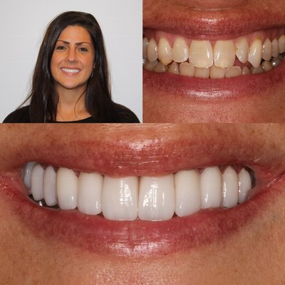Life changing senile makeovers are Dr. Ravin’s bread and butter! - Before and after a. Life changing. Life changing senile makeovers are Dr. Ravin’s bread and butter! - Before and after a. Life changing.