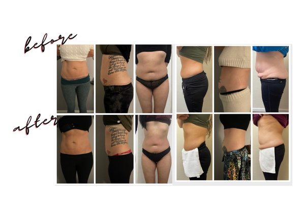 Happy Clients, Before and After - These images represent happy clients who committed to healthy lifestyle changes.  Body Sculpting results are more effective when sessions are consistent, committed clients who see this as just another component to creating a healthier and more confident you.