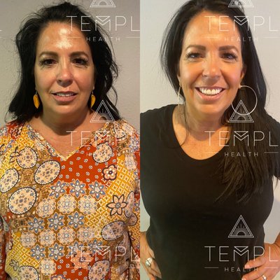 ChiroThin Weight Loss Program: One Round - Our doctor-supervised weight loss and detox program is about more than just weight loss. Check out some of our before and after pictures and stories from patients who completed one round of ChiroThin, on average losing 20+ pounds in just 6 weeks!!
No hormones, no injections, no pre-packaged meals, no weird shakes, no crazy exercise regiment, and no starving!! Just all-natural supplements, anti-inflammatory foods, and support from a Doctor!
No matter where you are starting from, we would love to help you on your journey to feeling like yourself again. <3 ChiroThin Weight Loss Program: One Round - Our doctor-supervised weight loss and detox program is about more than just weight loss. Check out some of our before and after pictures and stories from patients who completed one round of ChiroThin, on average losing 20+ pounds in just 6 weeks!!
No hormones, no injections, no pre-packaged meals, no weird shakes, no crazy exercise regiment, and no starving!! Just all-natural supplements, anti-inflammatory foods, and support from a Doctor!
No matter where you are starting from, we would love to help you on your journey to feeling like yourself again. <3