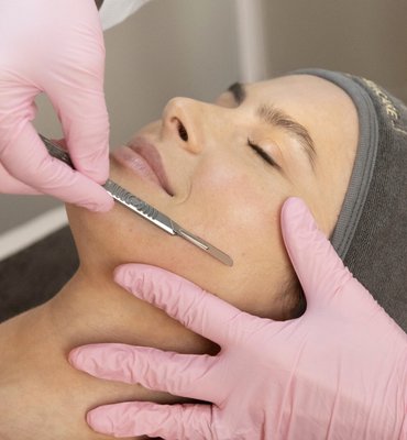 Hydrafacial + Dermaplaning - Descubre la magia de nuestra oferta especial: el tratamiento combinado de HydraFacial + Dermaplane ✨ Hydrafacial + Dermaplaning - Descubre la magia de nuestra oferta especial: el tratamiento combinado de HydraFacial + Dermaplane ✨