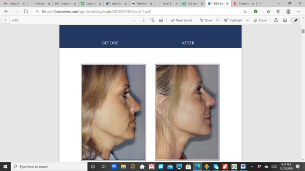 Fat elimination and skin tightening services - This new procedure offers a pain-free solution that targets the exact areas you want to eliminate fat, reshape your body and tighten your skin. Fat elimination and skin tightening services - This new procedure offers a pain-free solution that targets the exact areas you want to eliminate fat, reshape your body and tighten your skin.