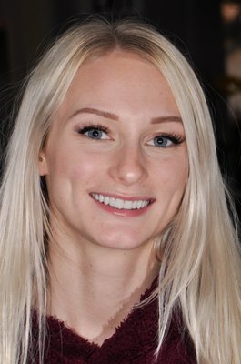 Veneers - Sometimes some teeth don't match the smile well.  Sometimes all the teeth would benefit from new shapes and color.  Veneers are a very quick way to create beautiful shapes and natural color to really make a smile pop!